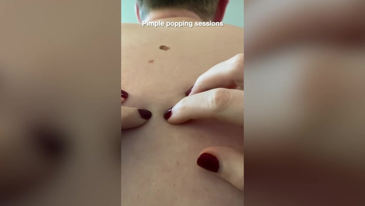 TikTok users save man’s life after spotting cancerous mole